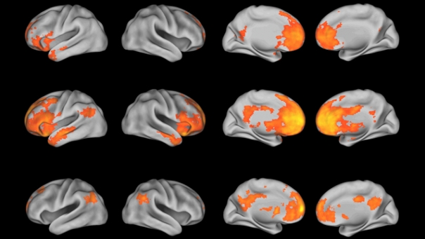  - brain-scans-colorful